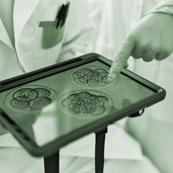 Fertility-related lab microscope image