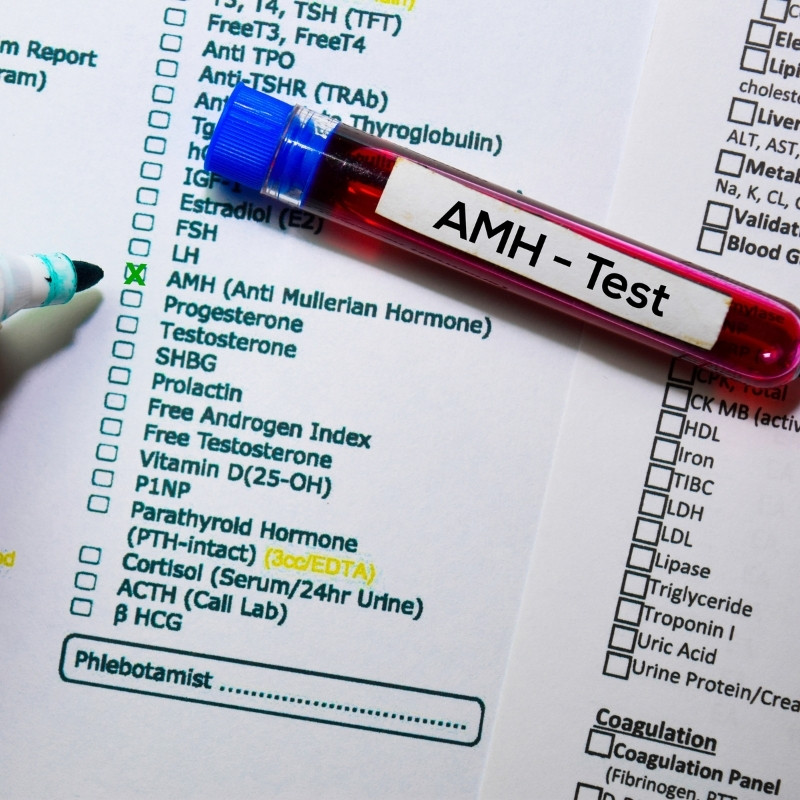 checklist of hormone tests with AMH