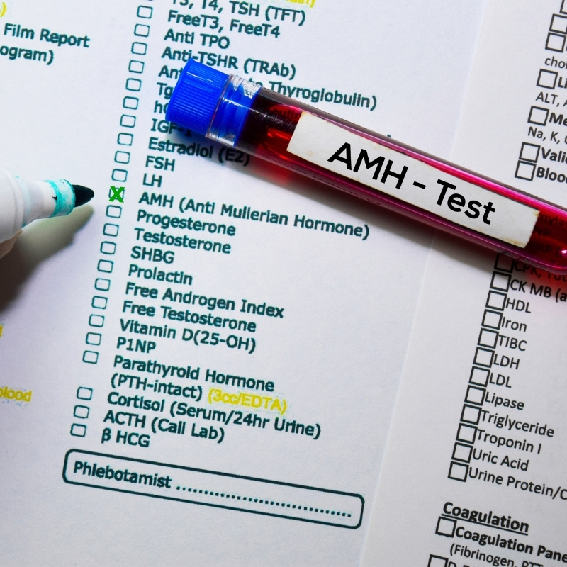 checklist of hormone tests with AMH