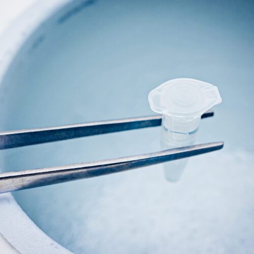 Egg Freezing: Common Questions Answered